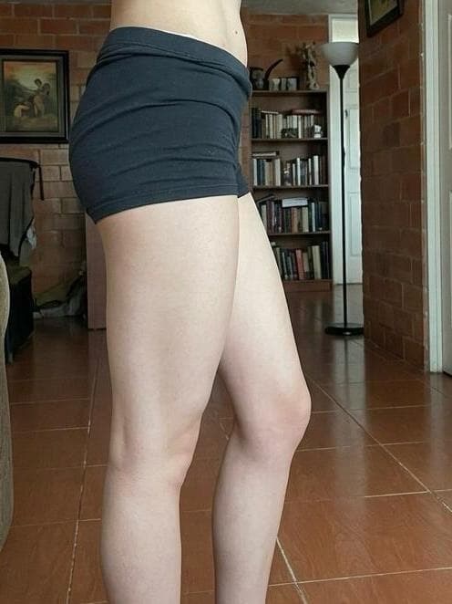 Andrea Torres — después